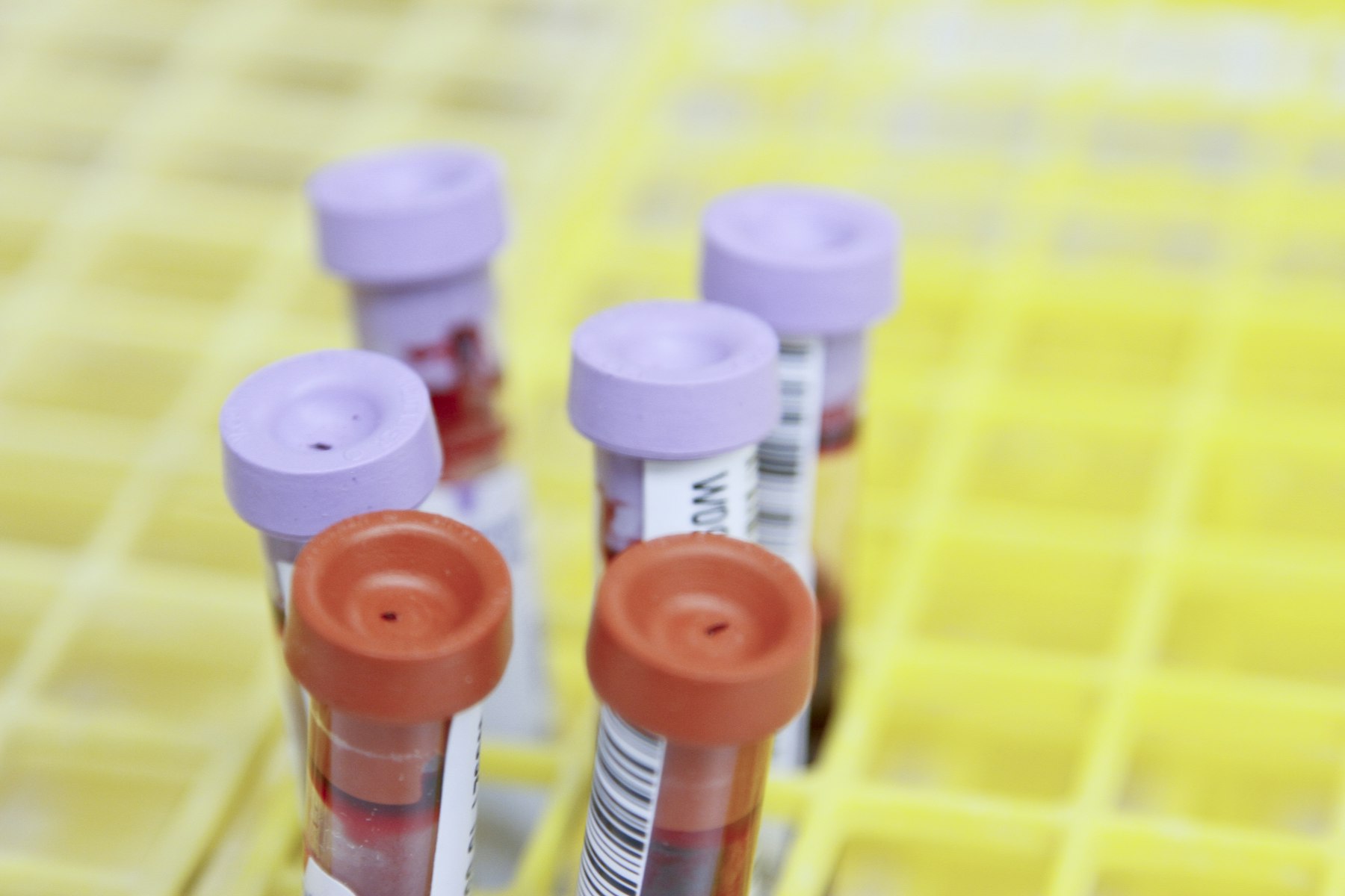 Blood collection tubes in a laboratory rack, representing Clinova’s laboratory testing.